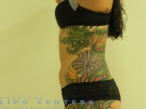 americanlipocenters_5.jpg